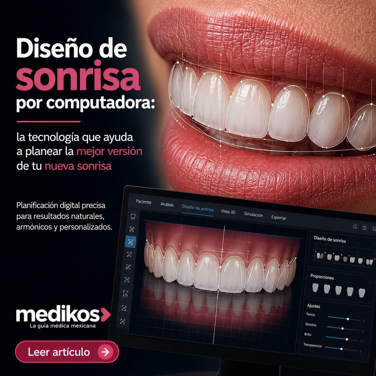 Paciente sonriendo en consulta de diseño de sonrisa